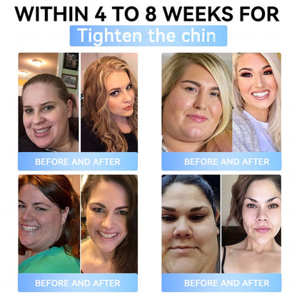 FDA Official Store | Myo Clinic GLP-1 Slim & Firm Nano Microneedle Patch with Collagen, Turmeric & Matrixyl 3000丨Obesity, Cardiovascular Disease, Diabetes, Sleep Apnea, Joint Problems and More