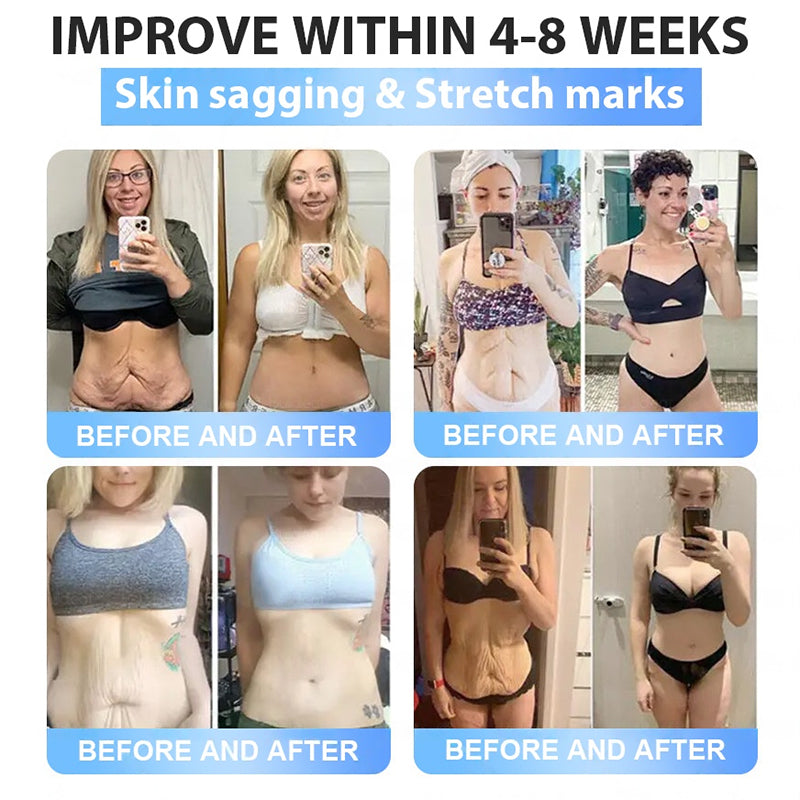 FDA Official Store | Myo Clinic GLP-1 Slim & Firm Nano Microneedle Patch with Collagen, Turmeric & Matrixyl 3000丨Obesity, Cardiovascular Disease, Diabetes, Sleep Apnea, Joint Problems and More