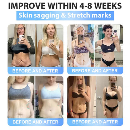 FDA Official Store | Myo Clinic GLP-1 Slim & Firm Nano Microneedle Patch with Collagen, Turmeric & Matrixyl 3000丨Obesity, Cardiovascular Disease, Diabetes, Sleep Apnea, Joint Problems and More