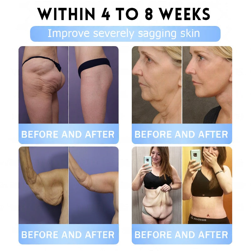 FDA Official Store | Myo Clinic GLP-1 Slim & Firm Nano Microneedle Patch with Collagen, Turmeric & Matrixyl 3000丨Obesity, Cardiovascular Disease, Diabetes, Sleep Apnea, Joint Problems and More