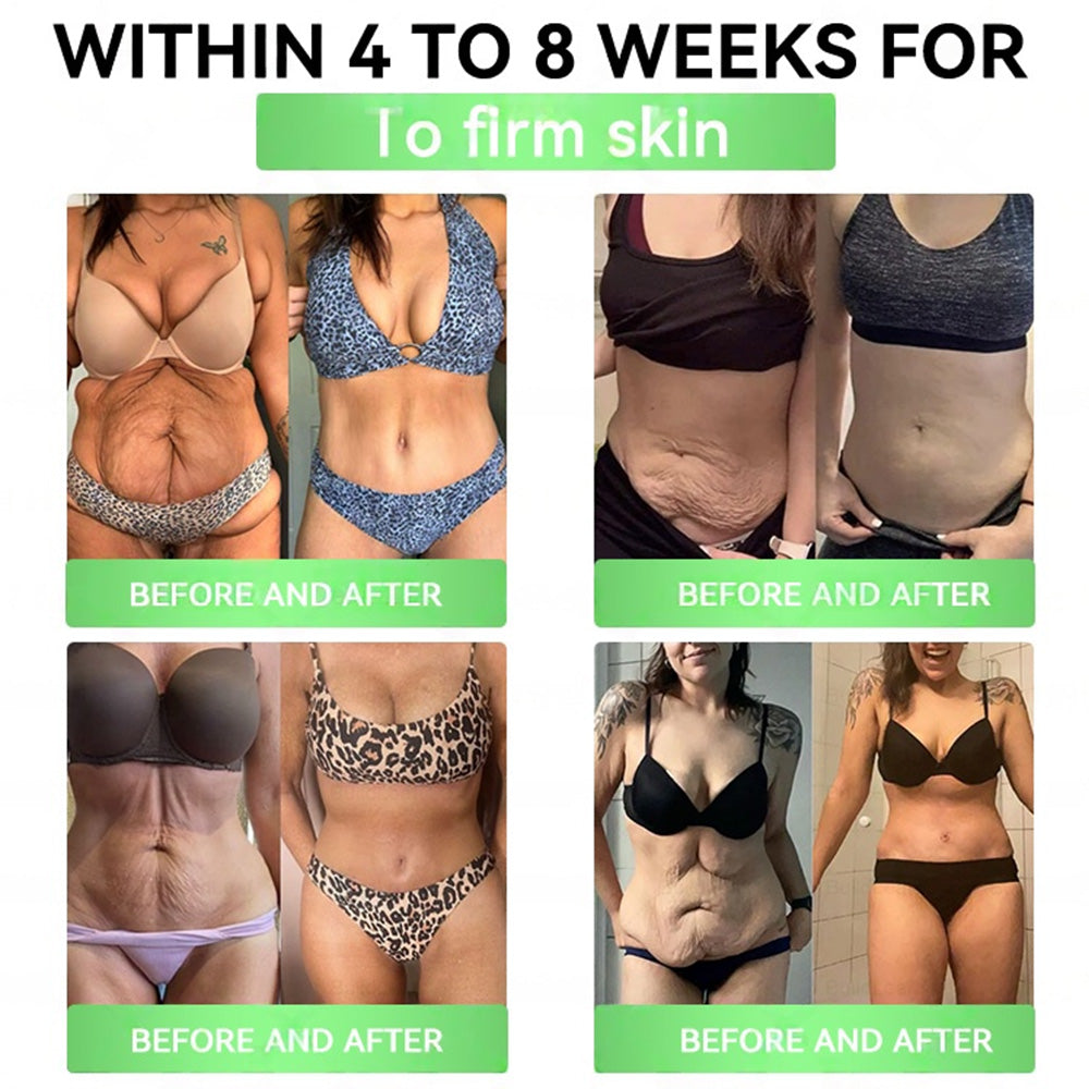 🇺🇸𝑶𝒏𝒍𝒊𝒏𝒆 𝑷𝒉𝒂𝒓𝒎𝒂𝒄𝒚 | 𝐏𝐄𝐀𝐊𝐀® 𝑮𝑳𝑷-𝟏+𝑺𝑮𝑳𝑻-𝟐𝒊 𝗦𝗹𝗶𝗺 & 𝑯𝒆𝒂𝒍𝒕𝒉 𝑶𝒓𝒂𝒍 𝑺𝒐𝒍𝒖𝒕𝒊𝒐𝒏 (𝑂𝑛𝑐𝑒 𝑎 𝑑𝑎𝑦, 𝑣𝑖𝑠𝑖𝑏𝑙𝑒 𝑟𝑒𝑠𝑢𝑙𝑡𝑠 𝑖𝑛 7 𝑑𝑎𝑦𝑠) ✅ 𝗦𝘂𝗽𝗽𝗼𝗿𝘁𝘀 𝗼𝗯𝗲𝘀𝗶𝘁𝘆, 𝗰𝗮𝗿𝗱𝗶𝗼𝘃𝗮𝘀𝗰𝘂𝗹𝗮𝗿 𝗵𝗲𝗮𝗹𝘁𝗵, 𝗱𝗶𝗮𝗯𝗲𝘁𝗲𝘀, 𝘀𝗹𝗲𝗲𝗽 𝗮𝗽𝗻𝗲𝗮, 𝗴𝘂𝘁 𝗵𝗲𝗮𝗹𝘁𝗵, 𝗷𝗼𝗶𝗻𝘁 𝗶𝘀𝘀𝘂𝗲𝘀, 𝐰𝐡𝐢𝐥𝐞 𝐚𝐥𝐬𝐨 𝐟𝐢𝐫𝐦𝐢𝐧𝐠 𝐭𝐡𝐞 𝐬𝐤𝐢𝐧 𝐚𝐧𝐝 𝐛𝐨𝐨𝐬𝐭𝐢𝐧𝐠 𝐞𝐧𝐞𝐫𝐠𝐲