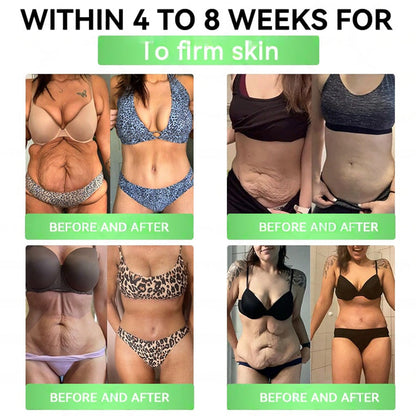 🇺🇸𝑶𝒏𝒍𝒊𝒏𝒆 𝑷𝒉𝒂𝒓𝒎𝒂𝒄𝒚 | 𝐏𝐄𝐀𝐊𝐀® 𝑮𝑳𝑷-𝟏+𝑺𝑮𝑳𝑻-𝟐𝒊 𝗦𝗹𝗶𝗺 & 𝑯𝒆𝒂𝒍𝒕𝒉 𝑶𝒓𝒂𝒍 𝑺𝒐𝒍𝒖𝒕𝒊𝒐𝒏 (𝑂𝑛𝑐𝑒 𝑎 𝑑𝑎𝑦, 𝑣𝑖𝑠𝑖𝑏𝑙𝑒 𝑟𝑒𝑠𝑢𝑙𝑡𝑠 𝑖𝑛 7 𝑑𝑎𝑦𝑠) ✅ 𝗦𝘂𝗽𝗽𝗼𝗿𝘁𝘀 𝗼𝗯𝗲𝘀𝗶𝘁𝘆, 𝗰𝗮𝗿𝗱𝗶𝗼𝘃𝗮𝘀𝗰𝘂𝗹𝗮𝗿 𝗵𝗲𝗮𝗹𝘁𝗵, 𝗱𝗶𝗮𝗯𝗲𝘁𝗲𝘀, 𝘀𝗹𝗲𝗲𝗽 𝗮𝗽𝗻𝗲𝗮, 𝗴𝘂𝘁 𝗵𝗲𝗮𝗹𝘁𝗵, 𝗷𝗼𝗶𝗻𝘁 𝗶𝘀𝘀𝘂𝗲𝘀, 𝐰𝐡𝐢𝐥𝐞 𝐚𝐥𝐬𝐨 𝐟𝐢𝐫𝐦𝐢𝐧𝐠 𝐭𝐡𝐞 𝐬𝐤𝐢𝐧 𝐚𝐧𝐝 𝐛𝐨𝐨𝐬𝐭𝐢𝐧𝐠 𝐞𝐧𝐞𝐫𝐠𝐲