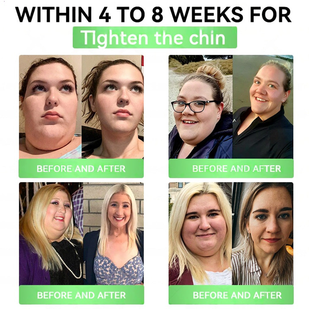 🇺🇸𝑶𝒏𝒍𝒊𝒏𝒆 𝑷𝒉𝒂𝒓𝒎𝒂𝒄𝒚 | 𝐏𝐄𝐀𝐊𝐀® 𝑮𝑳𝑷-𝟏+𝑺𝑮𝑳𝑻-𝟐𝒊 𝗦𝗹𝗶𝗺 & 𝑯𝒆𝒂𝒍𝒕𝒉 𝑶𝒓𝒂𝒍 𝑺𝒐𝒍𝒖𝒕𝒊𝒐𝒏 (𝑂𝑛𝑐𝑒 𝑎 𝑑𝑎𝑦, 𝑣𝑖𝑠𝑖𝑏𝑙𝑒 𝑟𝑒𝑠𝑢𝑙𝑡𝑠 𝑖𝑛 7 𝑑𝑎𝑦𝑠) ✅ 𝗦𝘂𝗽𝗽𝗼𝗿𝘁𝘀 𝗼𝗯𝗲𝘀𝗶𝘁𝘆, 𝗰𝗮𝗿𝗱𝗶𝗼𝘃𝗮𝘀𝗰𝘂𝗹𝗮𝗿 𝗵𝗲𝗮𝗹𝘁𝗵, 𝗱𝗶𝗮𝗯𝗲𝘁𝗲𝘀, 𝘀𝗹𝗲𝗲𝗽 𝗮𝗽𝗻𝗲𝗮, 𝗴𝘂𝘁 𝗵𝗲𝗮𝗹𝘁𝗵, 𝗷𝗼𝗶𝗻𝘁 𝗶𝘀𝘀𝘂𝗲𝘀, 𝐰𝐡𝐢𝐥𝐞 𝐚𝐥𝐬𝐨 𝐟𝐢𝐫𝐦𝐢𝐧𝐠 𝐭𝐡𝐞 𝐬𝐤𝐢𝐧 𝐚𝐧𝐝 𝐛𝐨𝐨𝐬𝐭𝐢𝐧𝐠 𝐞𝐧𝐞𝐫𝐠𝐲