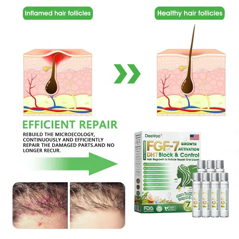 𝐅𝐃𝐀 | 𝐃𝐞𝐞𝐕𝐨𝐨®🇺🇸 𝐅𝐆𝐅-𝟕 𝐆𝐫𝐨𝐰𝐭𝐡 𝐀𝐜𝐭𝐢𝐯𝐚𝐭𝐢𝐨𝐧 𝐇𝐚𝐢𝐫 𝐑𝐞𝐠𝐫𝐨𝐰𝐭𝐡 & 𝐅𝐨𝐥𝐥𝐢𝐜𝐥𝐞 𝐑𝐞𝐩𝐚𝐢𝐫 𝐎𝐫𝐚𝐥 𝐋𝐢𝐪𝐮𝐢𝐝(Just once a day, visible changes in 7 days)For severe hair loss, alopecia areata, folliculitis, seborrheic dermatitis,scalp psoriasis, and other chronic scalp conditions