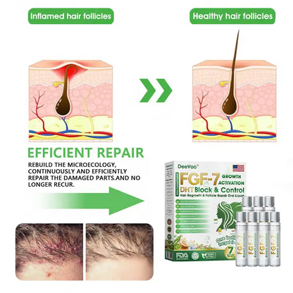 𝐅𝐃𝐀 | 𝐃𝐞𝐞𝐕𝐨𝐨®🇺🇸 𝐅𝐆𝐅-𝟕 𝐆𝐫𝐨𝐰𝐭𝐡 𝐀𝐜𝐭𝐢𝐯𝐚𝐭𝐢𝐨𝐧 𝐇𝐚𝐢𝐫 𝐑𝐞𝐠𝐫𝐨𝐰𝐭𝐡 & 𝐅𝐨𝐥𝐥𝐢𝐜𝐥𝐞 𝐑𝐞𝐩𝐚𝐢𝐫 𝐎𝐫𝐚𝐥 𝐋𝐢𝐪𝐮𝐢𝐝(Just once a day, visible changes in 7 days)For severe hair loss, alopecia areata, folliculitis, seborrheic dermatitis,scalp psoriasis, and other chronic scalp conditions