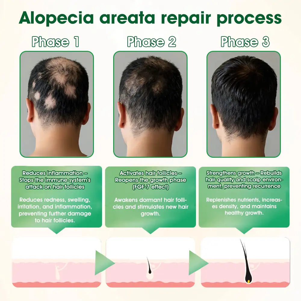 𝐅𝐃𝐀 | 𝐃𝐞𝐞𝐕𝐨𝐨®🇺🇸 𝐅𝐆𝐅-𝟕 𝐆𝐫𝐨𝐰𝐭𝐡 𝐀𝐜𝐭𝐢𝐯𝐚𝐭𝐢𝐨𝐧 𝐇𝐚𝐢𝐫 𝐑𝐞𝐠𝐫𝐨𝐰𝐭𝐡 & 𝐅𝐨𝐥𝐥𝐢𝐜𝐥𝐞 𝐑𝐞𝐩𝐚𝐢𝐫 𝐎𝐫𝐚𝐥 𝐋𝐢𝐪𝐮𝐢𝐝(Just once a day, visible changes in 7 days)For severe hair loss, alopecia areata, folliculitis, seborrheic dermatitis,scalp psoriasis, and other chronic scalp conditions