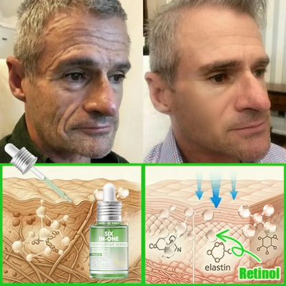 𝐎𝐫𝐢𝐚𝐜𝐡® 𝐀𝟏𝟎+ 𝟔-𝐢𝐧-𝟏 𝐃𝐞𝐫𝐦𝐚𝐑𝐞𝐩𝐚𝐢𝐫 𝐒𝐞𝐫𝐮𝐦 𝐅𝐃𝐀 𝐂𝐞𝐫𝐭𝐢𝐟𝐢𝐞𝐝 – 𝐅𝐢𝐫𝐦𝐬 𝐥𝐨𝐨𝐬𝐞 𝐬𝐤𝐢𝐧, 𝐟𝐚𝐝𝐞𝐬 𝐛𝐫𝐮𝐢𝐬𝐢𝐧𝐠 𝐚𝐧𝐝 𝐬𝐞𝐧𝐢𝐥𝐞 𝐩𝐮𝐫𝐩𝐮𝐫𝐚, 𝐚𝐧𝐝 𝐢𝐦𝐩𝐫𝐨𝐯𝐞𝐬 𝐤𝐞𝐫𝐚𝐭𝐢𝐧 𝐛𝐮𝐢𝐥𝐝𝐮𝐩, 𝐬𝐞𝐛𝐨𝐫𝐫𝐡𝐞𝐢𝐜 𝐝𝐞𝐫𝐦𝐚𝐭𝐢𝐭𝐢𝐬, 𝐚𝐧𝐝 𝐟𝐨𝐥𝐥𝐢𝐜𝐮𝐥𝐚𝐫 𝐤𝐞𝐫𝐚𝐭𝐨𝐬𝐢𝐬.