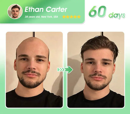 𝐅𝐃𝐀 | 𝐃𝐞𝐞𝐕𝐨𝐨®🇺🇸 𝐅𝐆𝐅-𝟕 𝐆𝐫𝐨𝐰𝐭𝐡 𝐀𝐜𝐭𝐢𝐯𝐚𝐭𝐢𝐨𝐧 𝐇𝐚𝐢𝐫 𝐑𝐞𝐠𝐫𝐨𝐰𝐭𝐡 & 𝐅𝐨𝐥𝐥𝐢𝐜𝐥𝐞 𝐑𝐞𝐩𝐚𝐢𝐫 𝐎𝐫𝐚𝐥 𝐋𝐢𝐪𝐮𝐢𝐝(Just once a day, visible changes in 7 days)For severe hair loss, alopecia areata, folliculitis, seborrheic dermatitis,scalp psoriasis, and other chronic scalp conditions