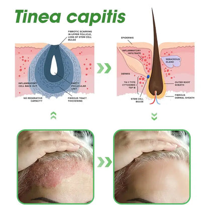 𝐅𝐃𝐀 | 𝐃𝐞𝐞𝐕𝐨𝐨®🇺🇸 𝐅𝐆𝐅-𝟕 𝐆𝐫𝐨𝐰𝐭𝐡 𝐀𝐜𝐭𝐢𝐯𝐚𝐭𝐢𝐨𝐧 𝐇𝐚𝐢𝐫 𝐑𝐞𝐠𝐫𝐨𝐰𝐭𝐡 & 𝐅𝐨𝐥𝐥𝐢𝐜𝐥𝐞 𝐑𝐞𝐩𝐚𝐢𝐫 𝐎𝐫𝐚𝐥 𝐋𝐢𝐪𝐮𝐢𝐝(Just once a day, visible changes in 7 days)For severe hair loss, alopecia areata, folliculitis, seborrheic dermatitis,scalp psoriasis, and other chronic scalp conditions