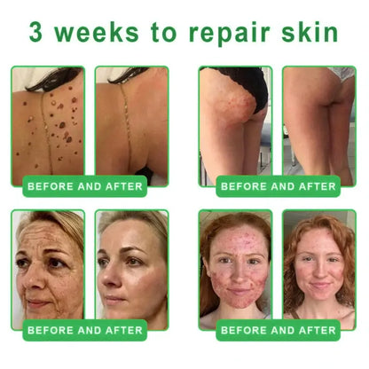 𝐎𝐫𝐢𝐚𝐜𝐡® 𝐀𝟏𝟎+ 𝟔-𝐢𝐧-𝟏 𝐃𝐞𝐫𝐦𝐚𝐑𝐞𝐩𝐚𝐢𝐫 𝐒𝐞𝐫𝐮𝐦 𝐅𝐃𝐀 𝐂𝐞𝐫𝐭𝐢𝐟𝐢𝐞𝐝 – 𝐅𝐢𝐫𝐦𝐬 𝐥𝐨𝐨𝐬𝐞 𝐬𝐤𝐢𝐧, 𝐟𝐚𝐝𝐞𝐬 𝐛𝐫𝐮𝐢𝐬𝐢𝐧𝐠 𝐚𝐧𝐝 𝐬𝐞𝐧𝐢𝐥𝐞 𝐩𝐮𝐫𝐩𝐮𝐫𝐚, 𝐚𝐧𝐝 𝐢𝐦𝐩𝐫𝐨𝐯𝐞𝐬 𝐤𝐞𝐫𝐚𝐭𝐢𝐧 𝐛𝐮𝐢𝐥𝐝𝐮𝐩, 𝐬𝐞𝐛𝐨𝐫𝐫𝐡𝐞𝐢𝐜 𝐝𝐞𝐫𝐦𝐚𝐭𝐢𝐭𝐢𝐬, 𝐚𝐧𝐝 𝐟𝐨𝐥𝐥𝐢𝐜𝐮𝐥𝐚𝐫 𝐤𝐞𝐫𝐚𝐭𝐨𝐬𝐢𝐬.