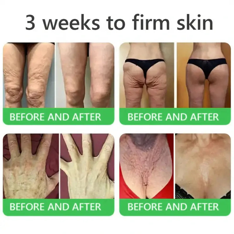 𝐎𝐫𝐢𝐚𝐜𝐡® 𝐀𝟏𝟎+ 𝟔-𝐢𝐧-𝟏 𝐃𝐞𝐫𝐦𝐚𝐑𝐞𝐩𝐚𝐢𝐫 𝐒𝐞𝐫𝐮𝐦 𝐅𝐃𝐀 𝐂𝐞𝐫𝐭𝐢𝐟𝐢𝐞𝐝 – 𝐅𝐢𝐫𝐦𝐬 𝐥𝐨𝐨𝐬𝐞 𝐬𝐤𝐢𝐧, 𝐟𝐚𝐝𝐞𝐬 𝐛𝐫𝐮𝐢𝐬𝐢𝐧𝐠 𝐚𝐧𝐝 𝐬𝐞𝐧𝐢𝐥𝐞 𝐩𝐮𝐫𝐩𝐮𝐫𝐚, 𝐚𝐧𝐝 𝐢𝐦𝐩𝐫𝐨𝐯𝐞𝐬 𝐤𝐞𝐫𝐚𝐭𝐢𝐧 𝐛𝐮𝐢𝐥𝐝𝐮𝐩, 𝐬𝐞𝐛𝐨𝐫𝐫𝐡𝐞𝐢𝐜 𝐝𝐞𝐫𝐦𝐚𝐭𝐢𝐭𝐢𝐬, 𝐚𝐧𝐝 𝐟𝐨𝐥𝐥𝐢𝐜𝐮𝐥𝐚𝐫 𝐤𝐞𝐫𝐚𝐭𝐨𝐬𝐢𝐬.